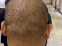 -华夏良子·足道SPA艾灸(铁道大厦店)