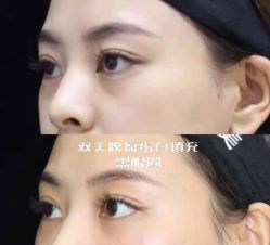 -上海漾颜医疗美容