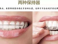 -团圆口腔·种植中心(锦江院区)