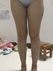 -广州美莱医疗美容医院