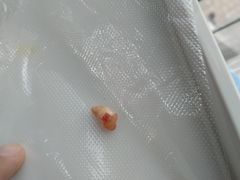 -同步齿科·数字化正畸种植口腔中心(珠海店)