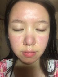 体验后-成都西区医院整形美容