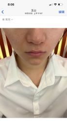 -铂特丽医美·眼鼻整形·光电美肤·注射抗衰