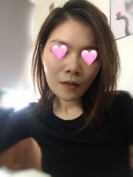 体验后-上海玫瑰医疗美容医院