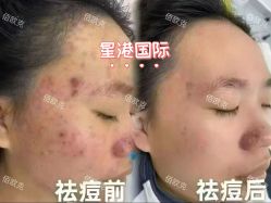 -星港国际·Skin皮肤专研·皮肤管理