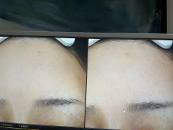 -苑苑vbeauty科技美容SPA