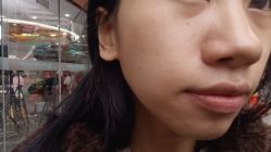 体验后-重庆军美医疗美容医院