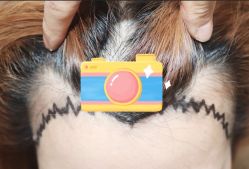 -大麦微针植发全国连锁