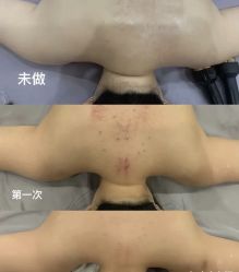 -Lily纤美·科技减脂中心
