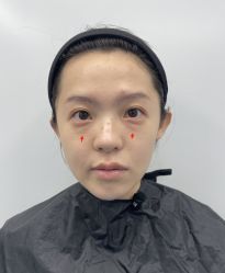 -天津健丽·去眼袋医疗美容机构