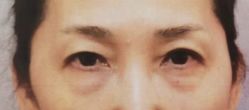体验前-深圳阳光医疗美容医院·旗舰店