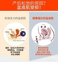 点击看大图 -奕美功能性体态调整·塑型·产后恢复(永利国际店)