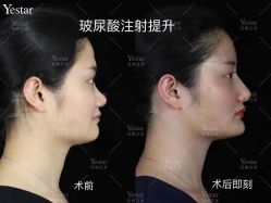 -Yestar艺星医疗美容医院