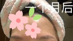 点击看大图 -Doris多里斯半永久纹眉·SMP纹发·发际线
