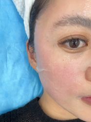 体验后-上海伊莱美医疗美容医院