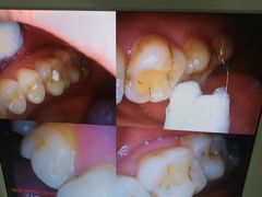 -土豆口腔(凤凰北总店)