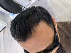 -雍禾植发全国连锁