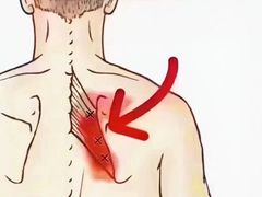 -名医堂永康中医·推拿正骨·针灸·艾灸