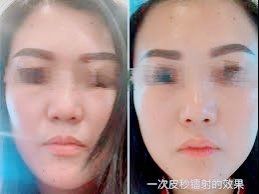 -SKINIST丽铂医疗美容