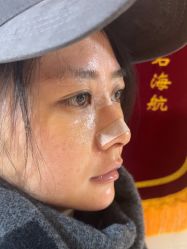 体验后-杭州美莱医疗美容医院