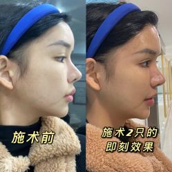 -杭州星婉馨悦医疗美容
