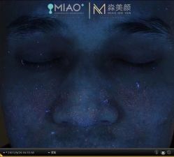 -韩国淼美颜皮肤管理官方直营店