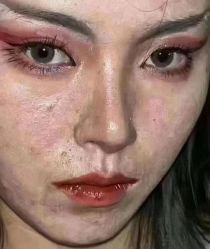 -瑶芳清颜草本祛痘
