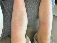 -佛冈森波拉度假区