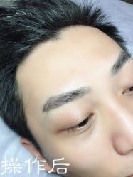 点击看大图 -西施无菌半永久纹绣眉眼影唇轻增发纹发际线