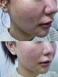 -Yestar 嘉兴艺星医疗美容医院
