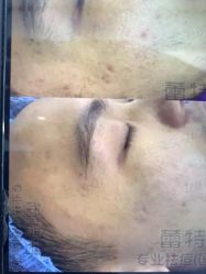 点击看大图 -蕾特恩专业祛痘·皮肤管理