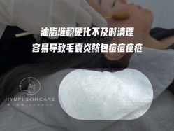 -MLP美丽派·问题肌疗愈中心