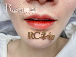 -RC半永久纹眉纹发际线