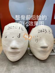 -小颜秘家·韩国整骨