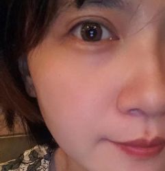 -针美汇欧邦医疗美容