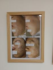 -美肤盾祛痘·问题肌头疗管理中心