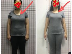 -修申骨雕小颜脊柱骨盆管理产后修复