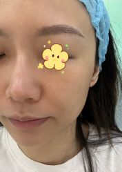 体验前-深圳鹏爱悦心医疗美容医院