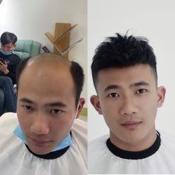 -发饰美男士增发补发假发定制店