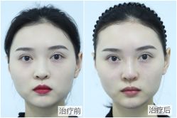 -美莱医学美容医院