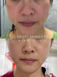 点击看大图 -MLP美丽派·问题肌疗愈中心