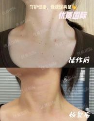 -木北造型