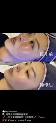 -安吉拉青春化管理中心