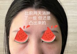 -美莱医疗美容医院