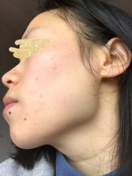 -皇族养心堂·净痘·修敏·御颜