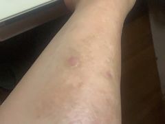 -杭州市第三人民医院