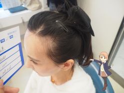 -大麦微针植发丨全国连锁