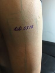 -天道专业洗纹身