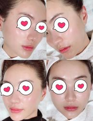 -素妍印象Ekrin Medi Clinic