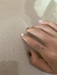 -一次性洗纹身·修复疤痕·超皮秒